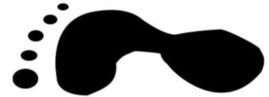 normal-foot-arch-area